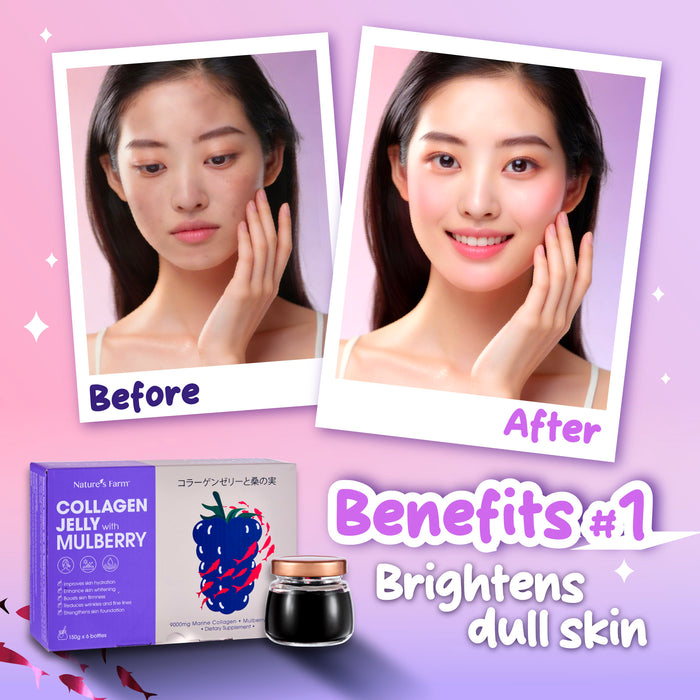 Nature's Farm® Collagen Jelly with Mulberry 150g x 6s